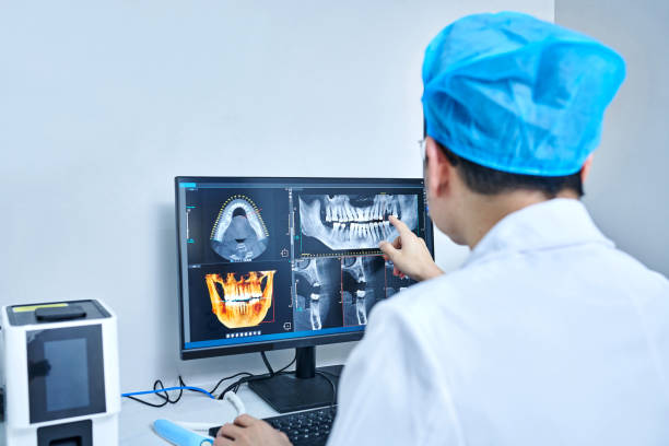Best Chipped Tooth Repair Near Me  in Diamond Springs, CA